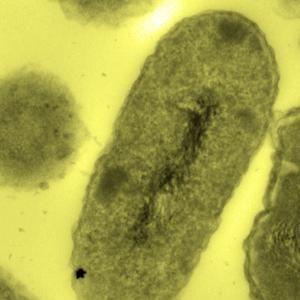 Bactérie Cupriavidus metallidurans.